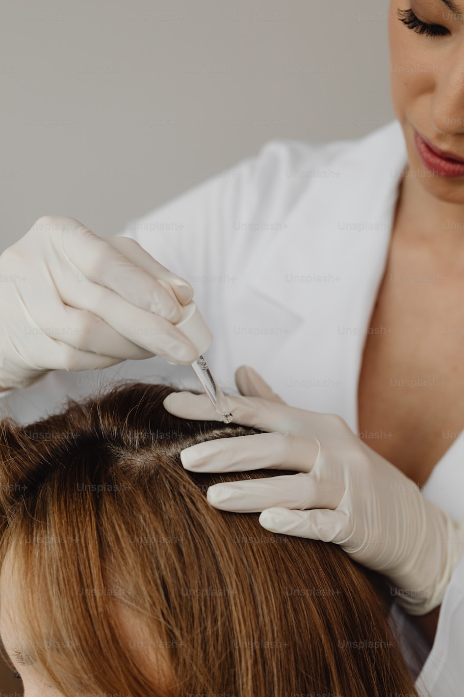 Hair Loss
